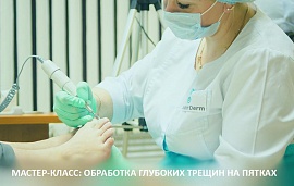 Мастер-класс DoctorDerm: аппаратная обработка глубоких трещин на пятках