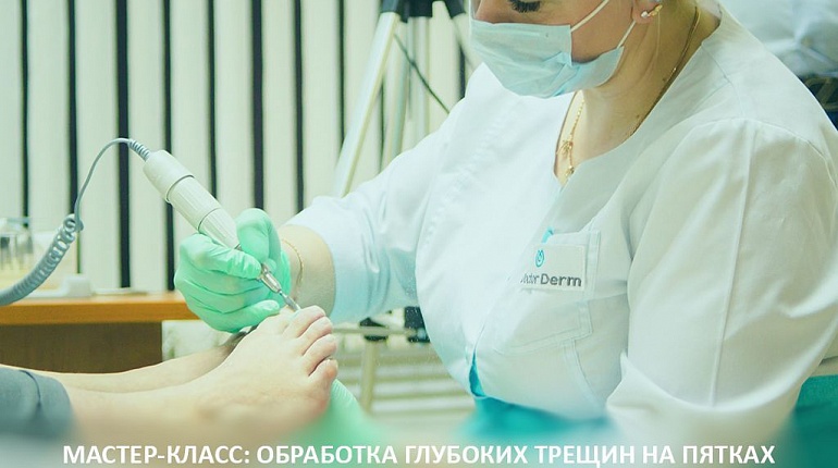 Мастер-класс DoctorDerm: аппаратная обработка глубоких трещин на пятках